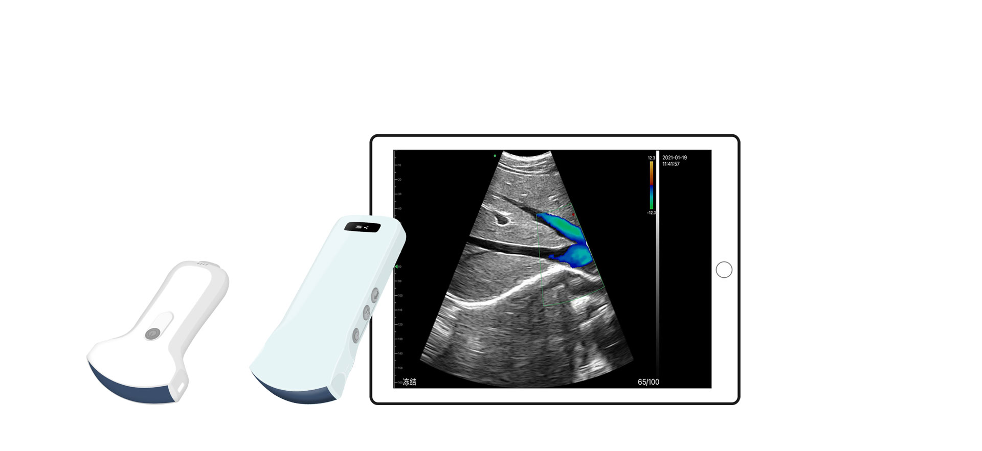 Quelles sont les applications cliniques des sondes d'échographie abdominale?