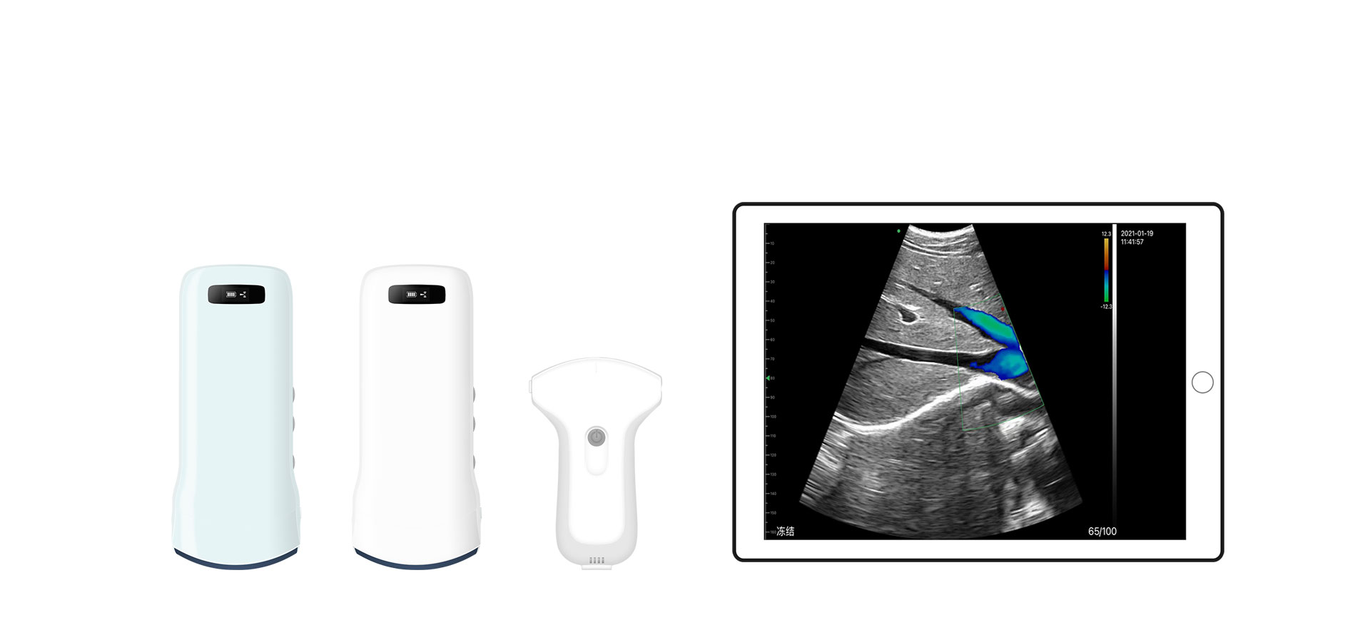 Sondes convexes d'échographie de l'abdomen