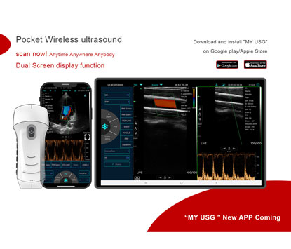 Caractéristiques de la sonde cardiaque linéaire convexe à ultrasons multi-usages C10T