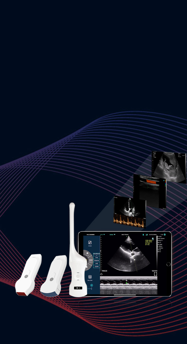 Sonde à ultrasons sans fil à double tête