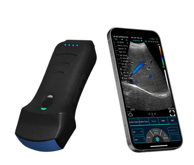 bluetooth ultrasound