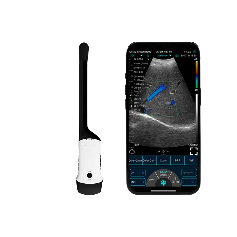 Le scanner portable à ultrasons ouvre une nouvelle ère dans l'examen médical