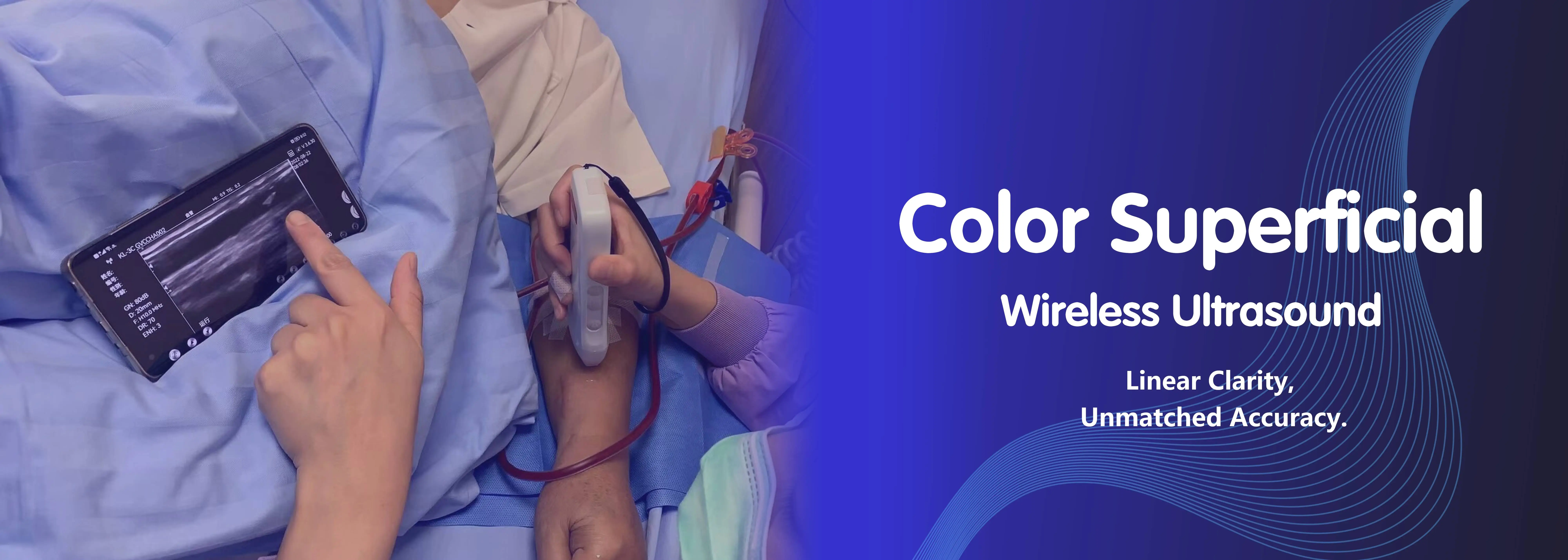 Échographie superficielle de couleur